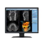 Monitor Medicale Eizo Radiforce MX217-SB 21″ IPS 3:4