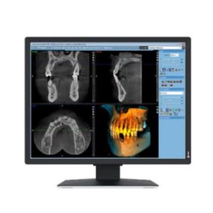 Monitor Medicale Eizo Radiforce MX217-SB 21" IPS 3:4
