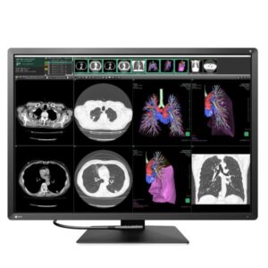 Monitor Medicale Eizo Radiforce RX1270 30.9" 3:2 4.2K IPS